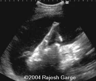 pic5a