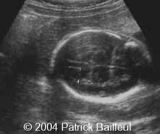 Picture1