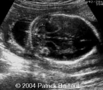 Picture2