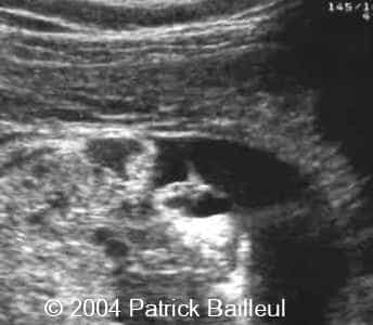 Picture5