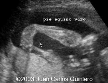 PIE EQ VARO