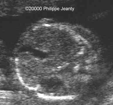 pj-1