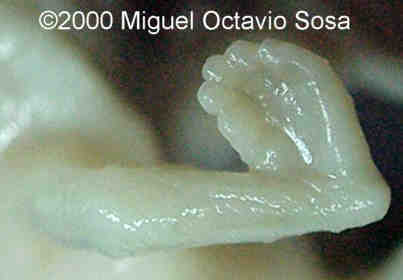 poc-5