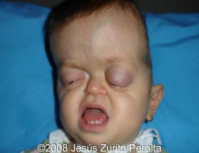 postnatal-2