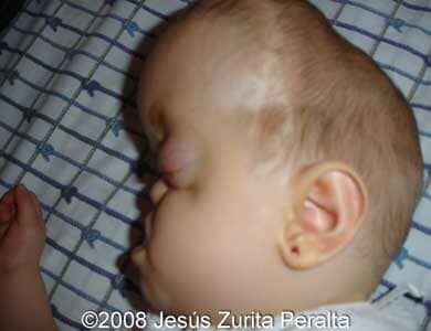 postnatal-4
