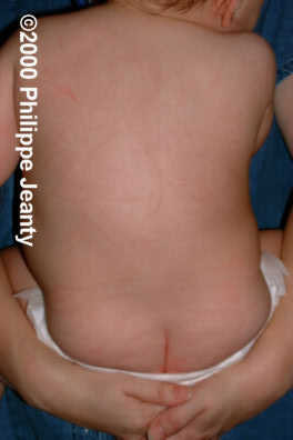 postnatal
