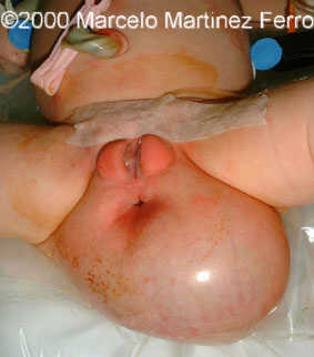 postnatal1