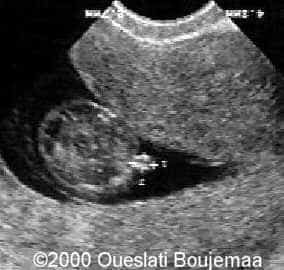 proboscis_11sa5j