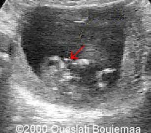 proboscisprofil_11sa5j