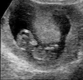 profil_11sa5j