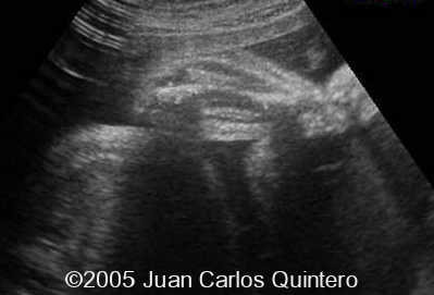 R CUBITO