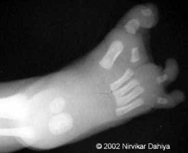 Right Foot