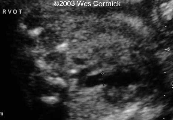 rvot