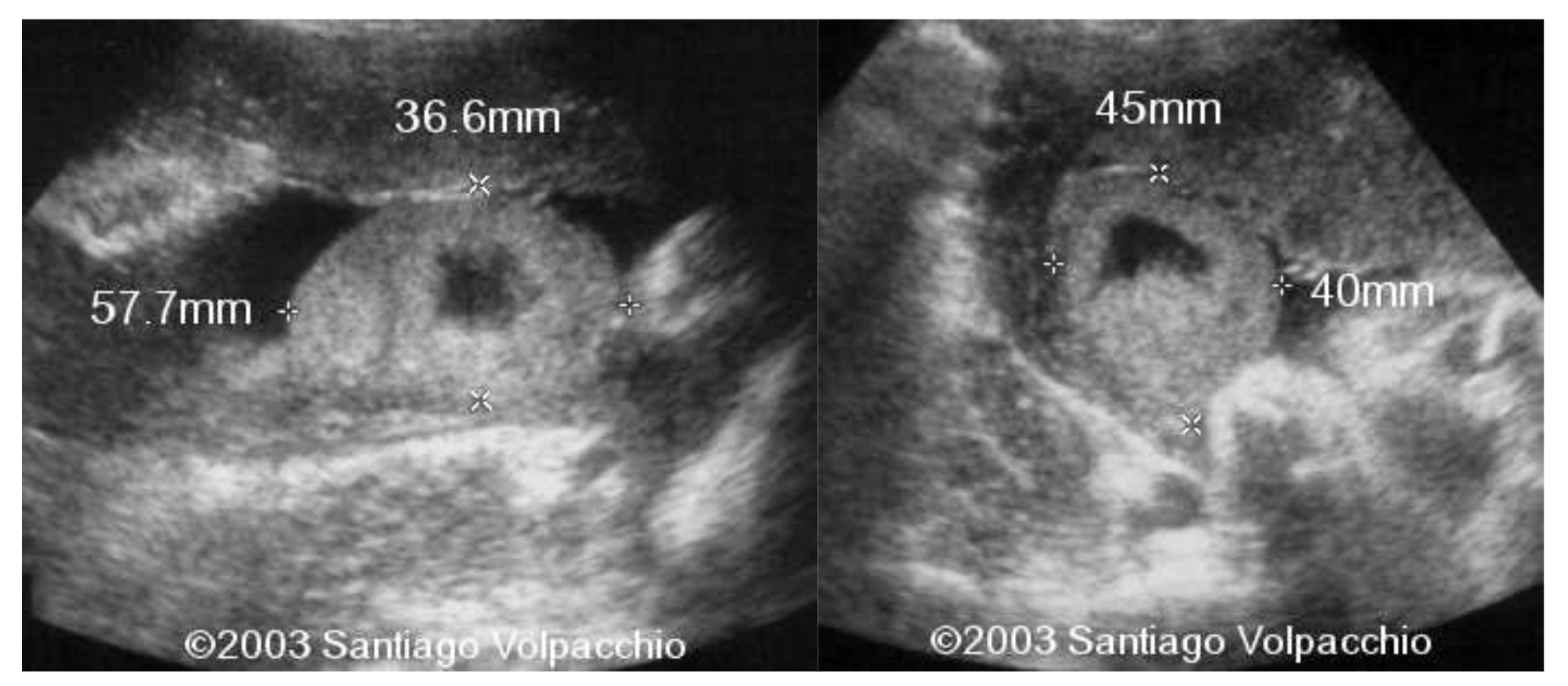 suc placenta