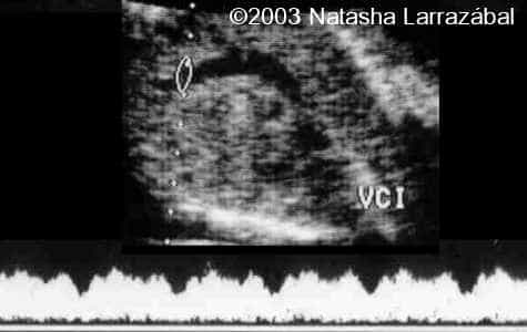 T 18 The fetus 9