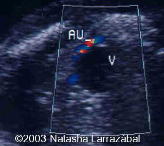 T18 The fetus 12