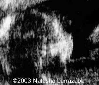 T18 The fetus 5