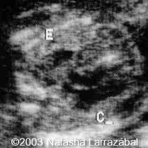 T18 The fetus 7