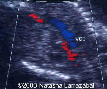T18 The fetus 8