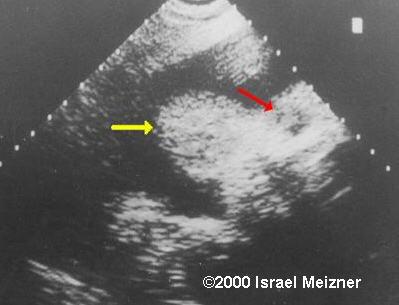 tumors_of_skin_meizner-1
