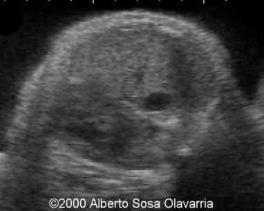 vena cava