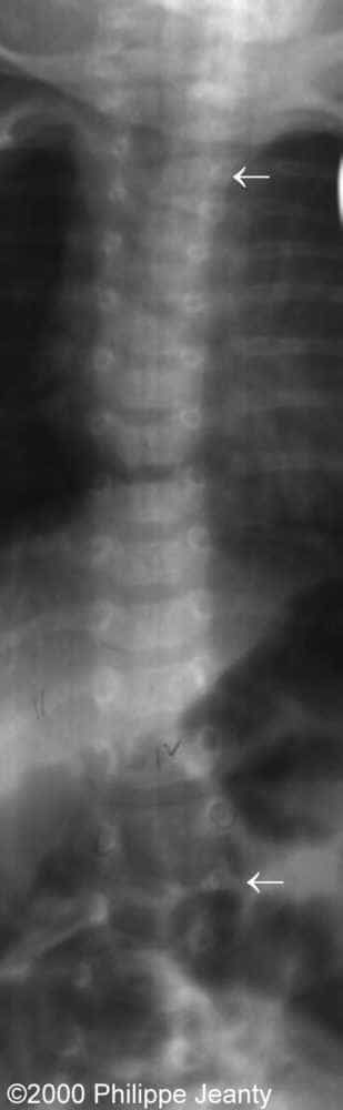 x-ray-1