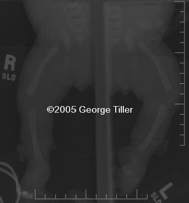 xray-1a