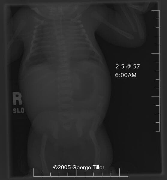 xray-2a