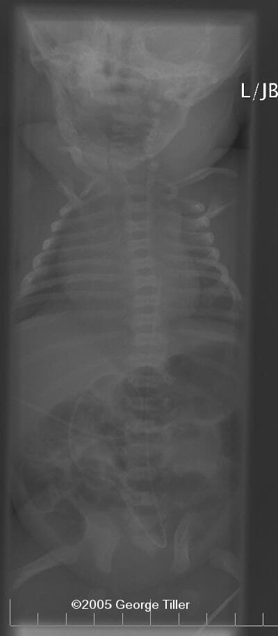 xray-3a