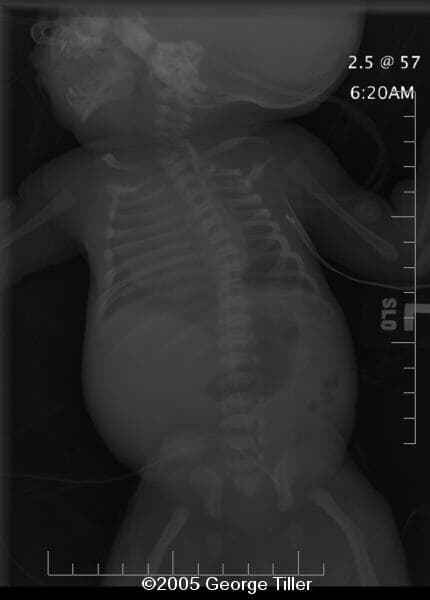 xray-4a